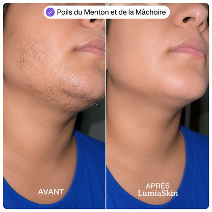 Kit Visage Lisse Sans Douleur