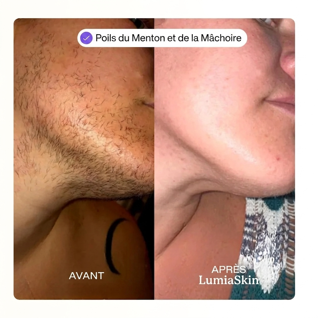 Kit Épilation Visage Douceur