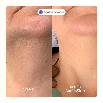 Kit Épilation Visage Douceur